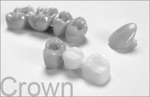 Crown
